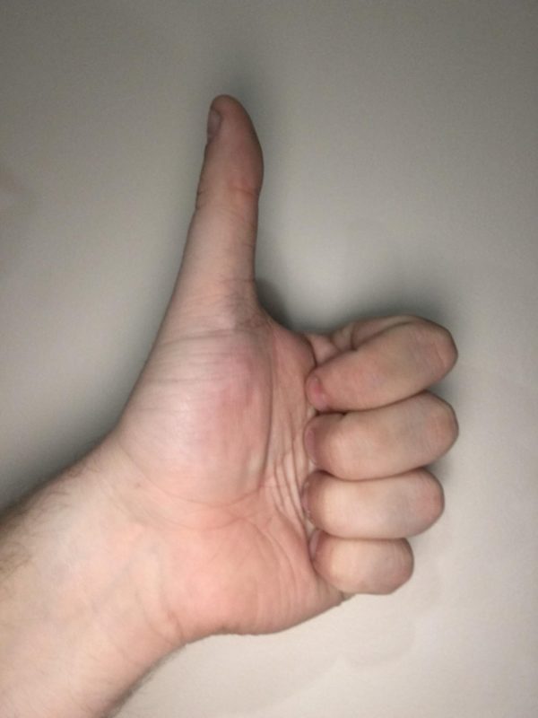 Two Thirds Of A Thumb